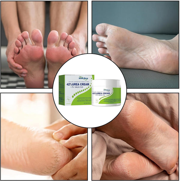 South Moon - 42% Urea Cream